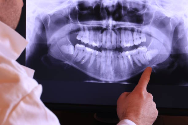 Best Emergency Treatment for Dental Infections or Abscesses in Harrah, OK